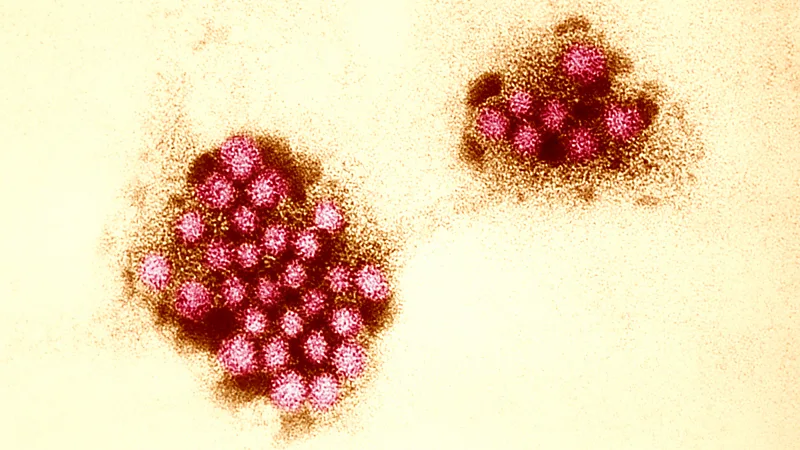 A genetic quirk protects some people from norovirus. Can vaccines help the rest of us?